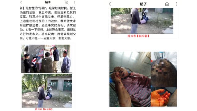 Ruan Yingxin ha ferito Lei Debin con un coltello