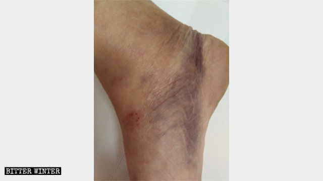 Il piede di Wei Lihui è stato ferito durante l'aggressione 